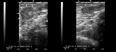 Clinical and Histological Features of Ovarian Hypoplasia/Dysgenesis in Alpacas